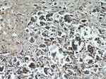 Cathepsin B Antibody in Immunohistochemistry (Paraffin) (IHC (P))