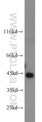 Cathepsin B Antibody in Western Blot (WB)