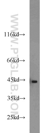 Cathepsin B Antibody in Western Blot (WB)