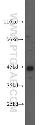 Cathepsin B Antibody in Western Blot (WB)