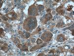 Gamma cystathionase Antibody in Immunohistochemistry (Paraffin) (IHC (P))