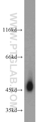 Gamma cystathionase Antibody in Western Blot (WB)