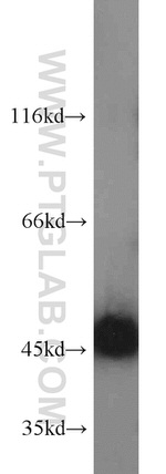 Gamma cystathionase Antibody in Western Blot (WB)