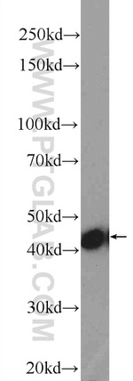 Gamma cystathionase Antibody in Western Blot (WB)