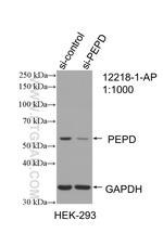 PEPD Antibody in Western Blot (WB)