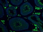 STAR Antibody in Immunohistochemistry (PFA fixed) (IHC (PFA))