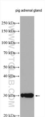 STAR Antibody in Western Blot (WB)