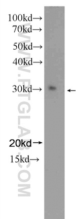 STAR Antibody in Western Blot (WB)