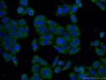 SH2B1 Antibody in Immunocytochemistry (ICC/IF)