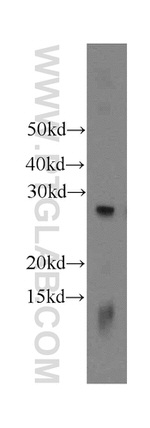 EIF4E2 Antibody in Western Blot (WB)