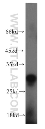EIF4E2 Antibody in Western Blot (WB)