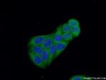 CALCOCO2 Antibody in Immunocytochemistry (ICC/IF)