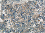 CALCOCO2 Antibody in Immunohistochemistry (Paraffin) (IHC (P))