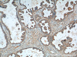 CALCOCO2 Antibody in Immunohistochemistry (Paraffin) (IHC (P))