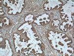 CALCOCO2 Antibody in Immunohistochemistry (Paraffin) (IHC (P))