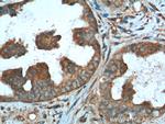 CALCOCO2 Antibody in Immunohistochemistry (Paraffin) (IHC (P))