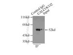 CALCOCO2 Antibody in Immunoprecipitation (IP)