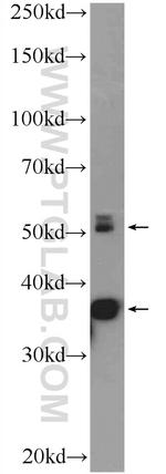 CALCOCO2 Antibody in Western Blot (WB)