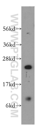 RBBP9 Antibody in Western Blot (WB)