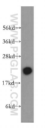 RBBP9 Antibody in Western Blot (WB)