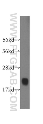 RBBP9 Antibody in Western Blot (WB)