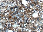 NT5E/CD73 Antibody in Immunohistochemistry (Paraffin) (IHC (P))