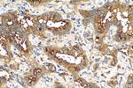 NT5E/CD73 Antibody in Immunohistochemistry (Paraffin) (IHC (P))