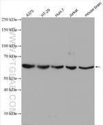 NT5E/CD73 Antibody in Western Blot (WB)