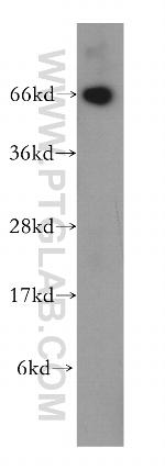 NT5E/CD73 Antibody in Western Blot (WB)