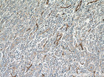 NT5E/CD73 Antibody in Immunohistochemistry (Paraffin) (IHC (P))