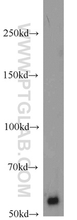 NT5E/CD73 Antibody in Western Blot (WB)