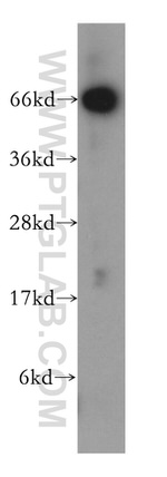 NT5E/CD73 Antibody in Western Blot (WB)