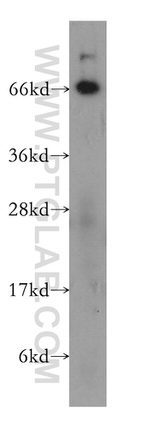 NT5E/CD73 Antibody in Western Blot (WB)