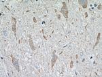 PRKACB Antibody in Immunohistochemistry (Paraffin) (IHC (P))