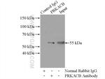 PRKACB Antibody in Immunoprecipitation (IP)