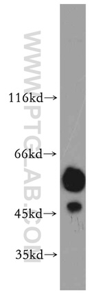 PRKACB Antibody in Western Blot (WB)