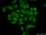 NUR77 Antibody in Immunocytochemistry (ICC/IF)