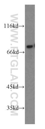 NUR77 Antibody in Western Blot (WB)