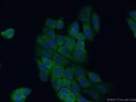 DNAJA2 Antibody in Immunocytochemistry (ICC/IF)