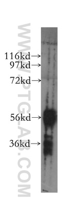 DYRK1B Antibody in Western Blot (WB)