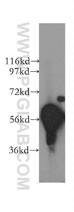 DYRK1B Antibody in Western Blot (WB)