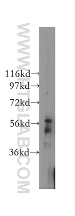 DYRK1B Antibody in Western Blot (WB)