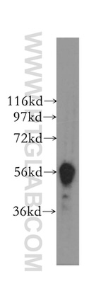 DYRK1B Antibody in Western Blot (WB)