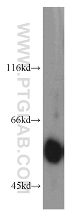 LCAT Antibody in Western Blot (WB)