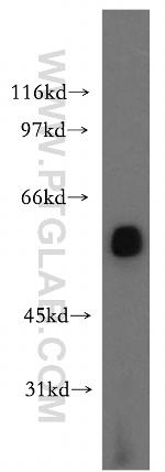 LCAT Antibody in Western Blot (WB)