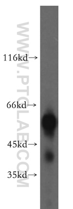 LCAT Antibody in Western Blot (WB)