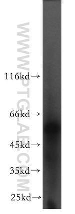 LCAT Antibody in Western Blot (WB)