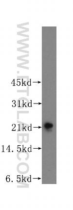 TAGLN3 Antibody in Western Blot (WB)