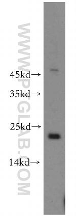 POLR1D Antibody in Western Blot (WB)