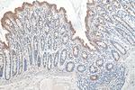 RCAS1 Antibody in Immunohistochemistry (Paraffin) (IHC (P))